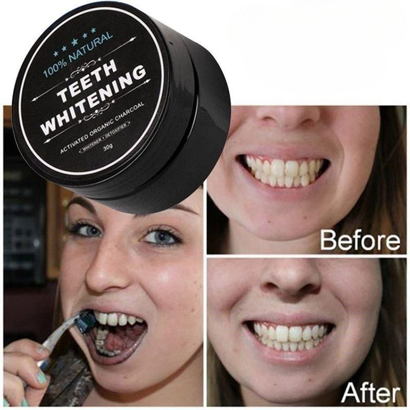 1 Pudełko Proszku do Wybielani – Teeth Whitening Pens recenzja i cena